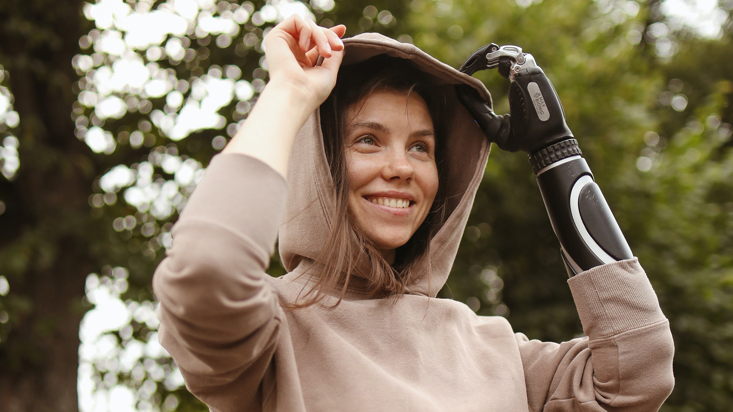 Frau mit einer Prothese am Arm - Berufsunfähigkeitsversicherung